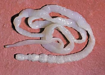 Ancaman Cacingan pada Anak Indonesia: Jenis dan Dampaknya