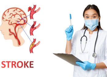 Inilah Cara Pencegahan Stroke pada Usia Muda yang Harus Diketahui oleh Milenial
