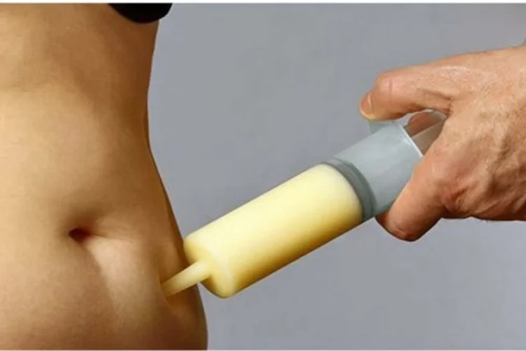 5 Bahaya Sedot Lemak yang Diduga Menyebabkan Kematian Selebgram Medan