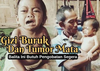 Urgent: Open Donasi untuk Aneira Hazna Juliani