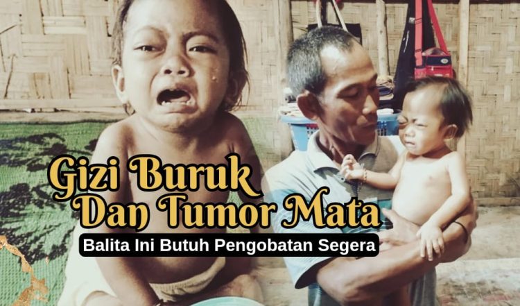 Urgent: Open Donasi untuk Aneira Hazna Juliani