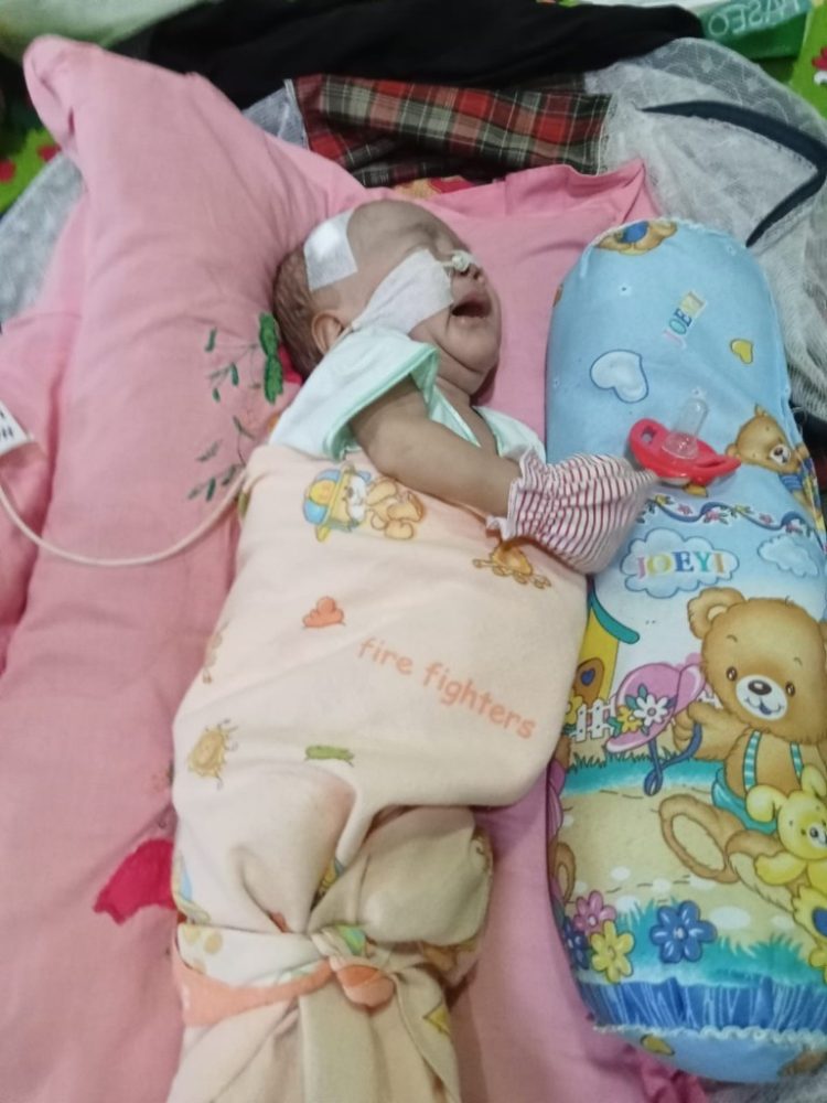 Fais Jaya, Pejuang Kecil yang Berjuang Melawan Jantung Bocor dan Paru-Paru Kempes