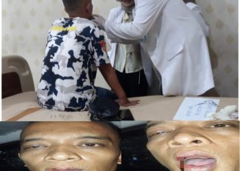 Diduga Dianiaya di Gereja, Warga Bandar Lampung Laporkan Mahasiswa Teologi ke Polisi